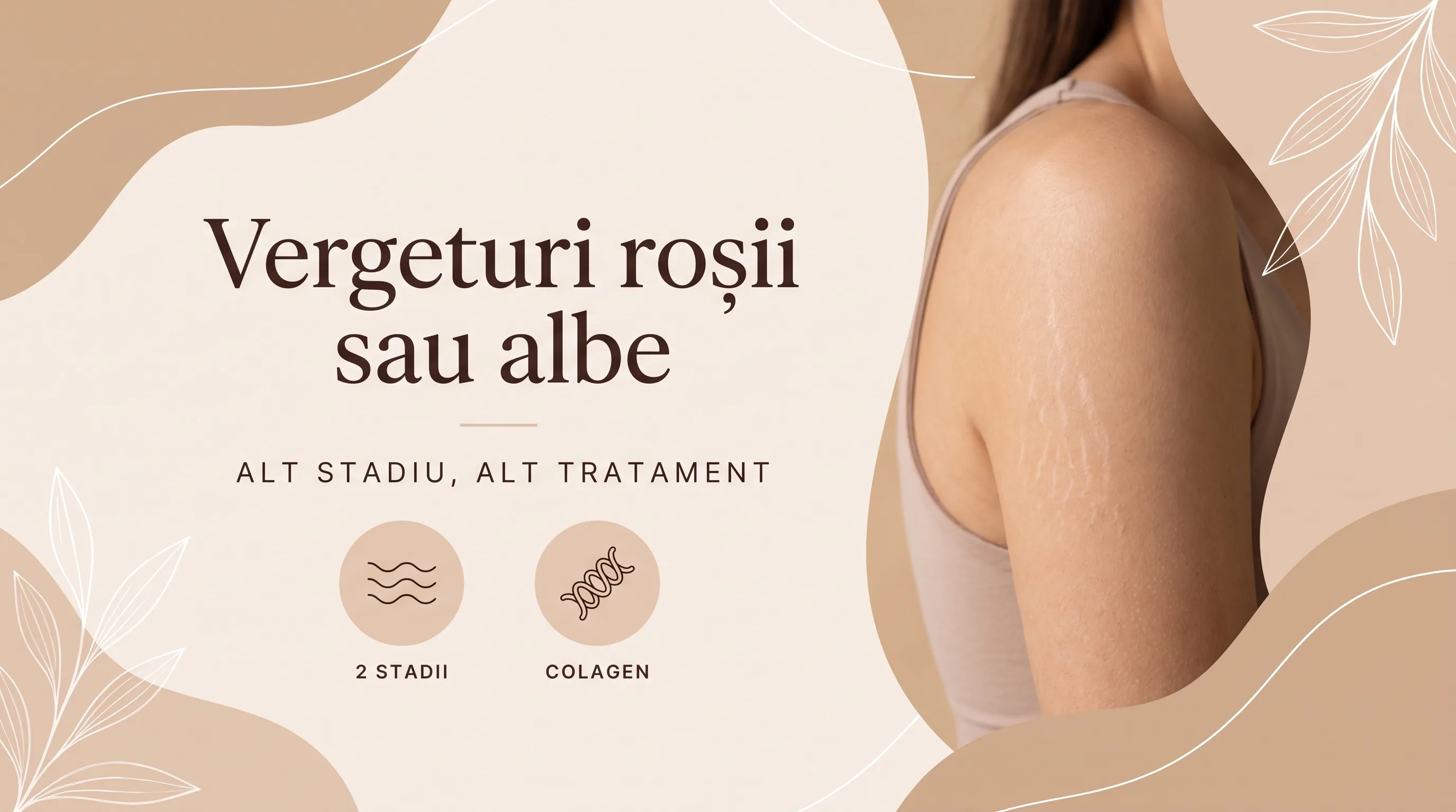 Vergeturi: ce tratamente funcționează, în funcție de vârsta lor